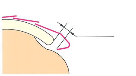 Stretch less than 1mm Do not stretch more than 2mm